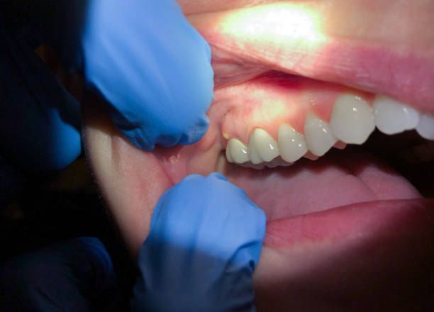 Best Emergency Cosmetic Dentistry (e.g., broken veneers) in Bad Axe, MI